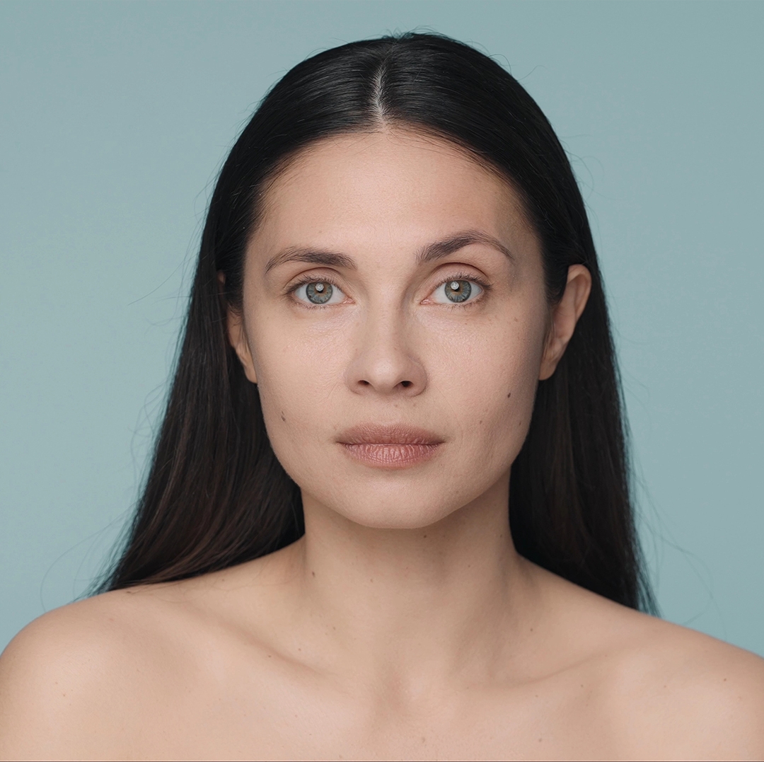 Fraksiyonel Lazer Nedir? Leke ve İzlerde Nasıl Etki Gösterir?