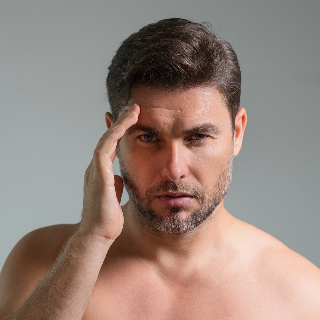 Erkeklerde Alın ve Şakak Bölgesi Neden Daha Çabuk Yaşlanır?